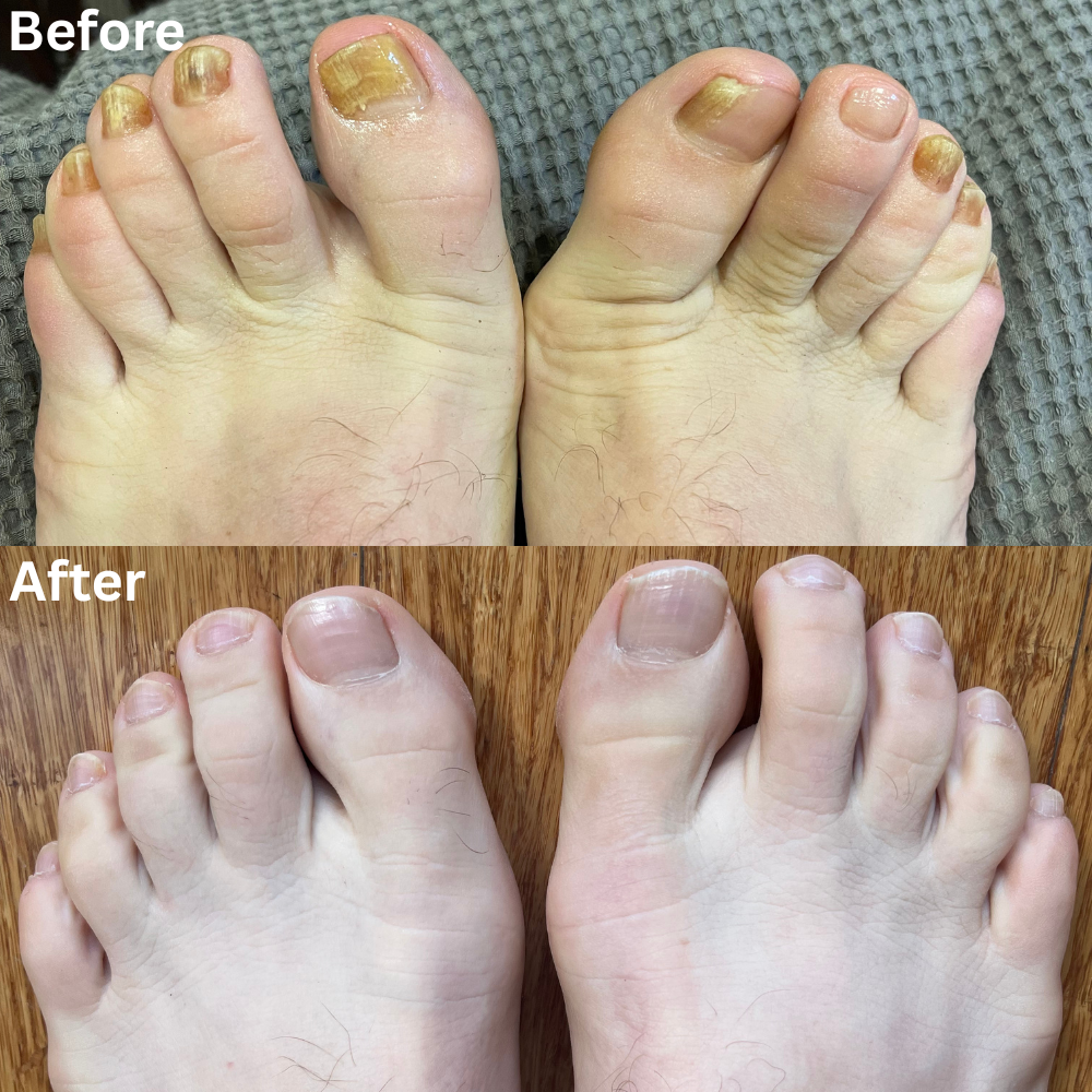 Nail Rescue Kit
