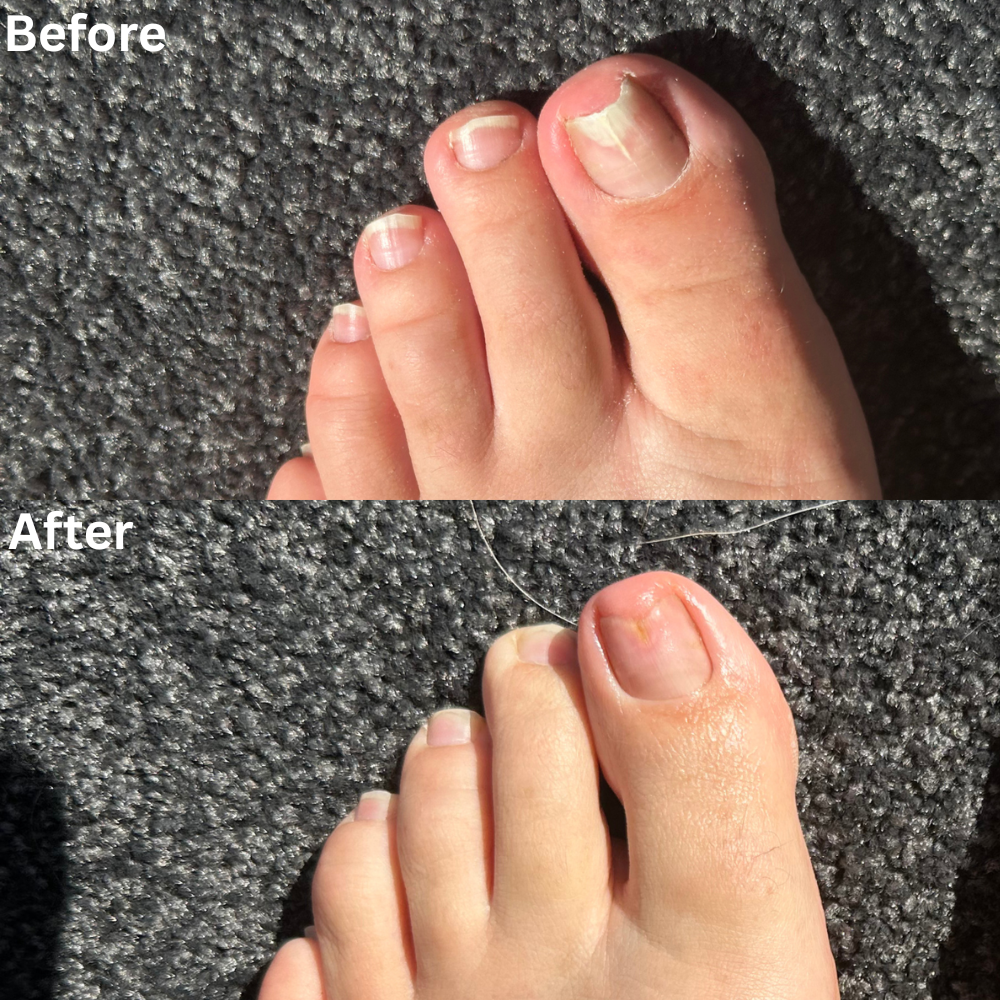 Nail Rescue Kit