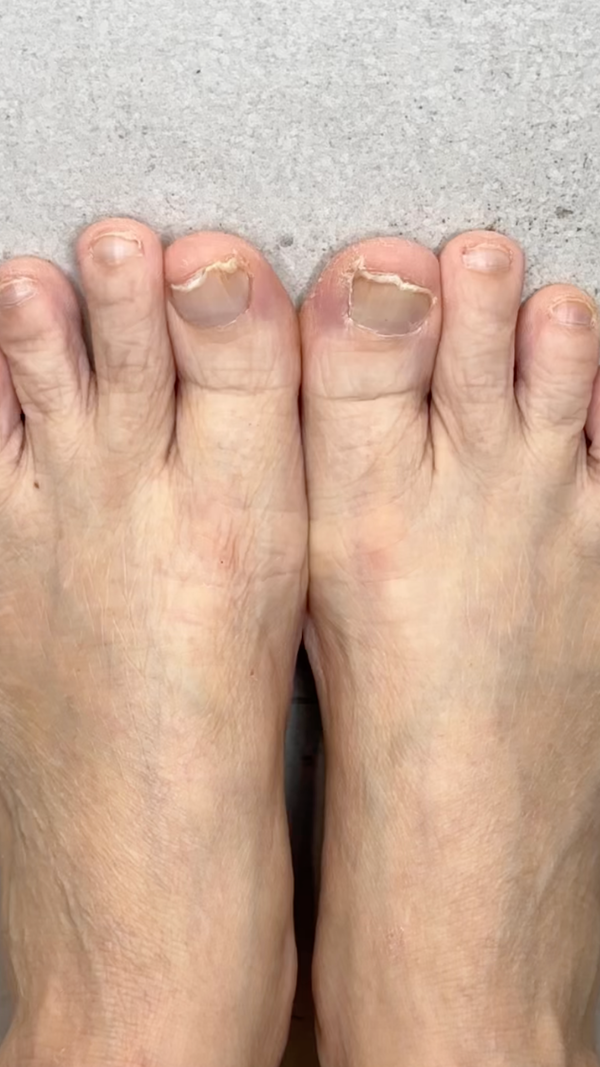 Before - MICHELLE D. (53)