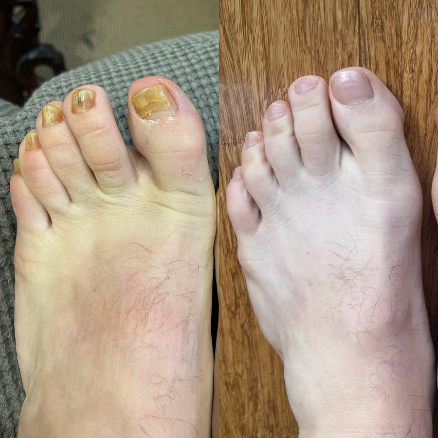 FixaNail step image