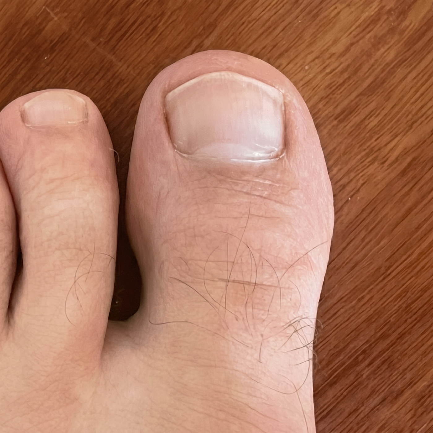 Before using FixaNail