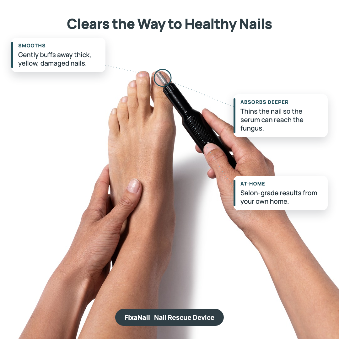 Nail Rescue Kit