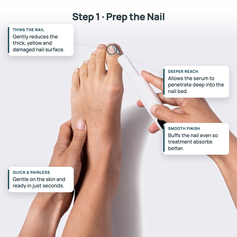Nail Rescue Max