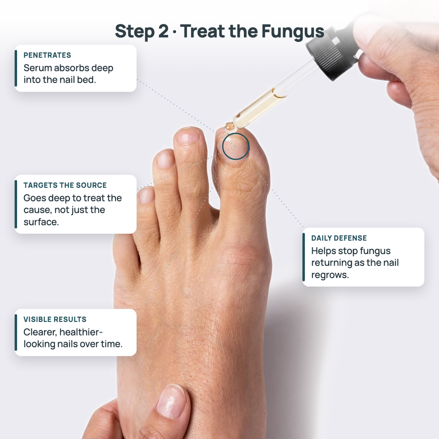 FixaNail™ Antifungal Serum
